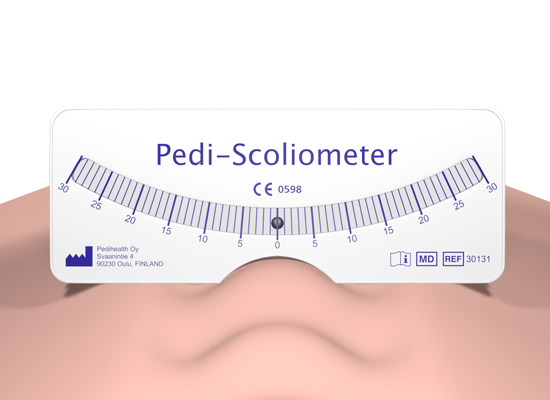 Pedi-Scoliometer: 3D preview #1 | Pedihealth Oy