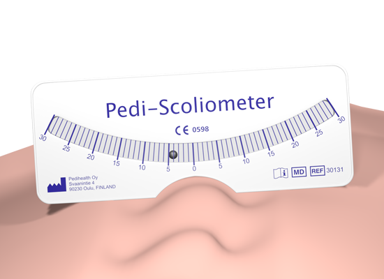 Pedi-Scoliometer: 3D preview #2 | Pedihealth Oy